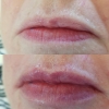 Sue Lips February 2018