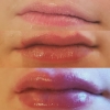 Lips February 2018