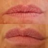 dawn lips feb 2018