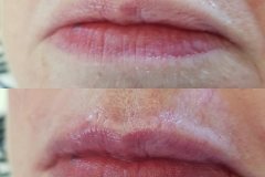 Sue Lips February 2018