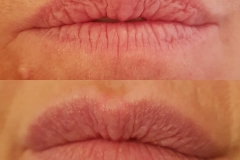 dawn lips feb 2018